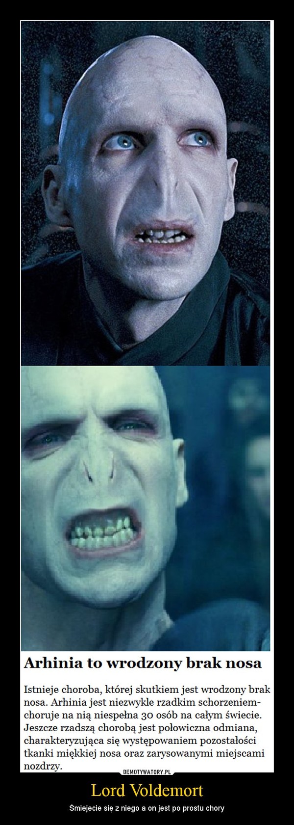 Lord Voldemort – Śmiejecie się z niego a on jest po prostu chory 