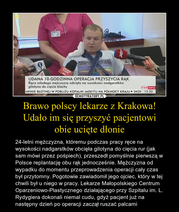 Brawo polscy lekarze z Krakowa!
Udało im się przyszyć pacjentowi
obie ucięte dłonie