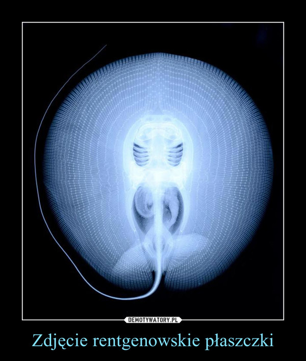 Zdjęcie rentgenowskie płaszczki –  