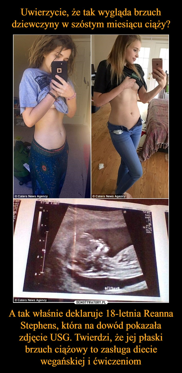 A tak właśnie deklaruje 18-letnia Reanna Stephens, która na dowód pokazała zdjęcie USG. Twierdzi, że jej płaski brzuch ciążowy to zasługa diecie wegańskiej i ćwiczeniom –  