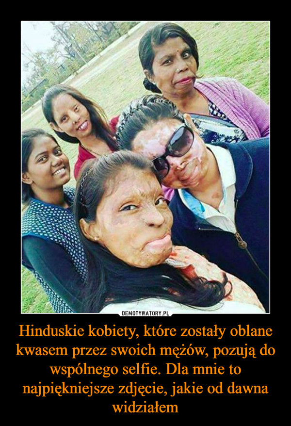 Hinduskie kobiety, które zostały oblane kwasem przez swoich mężów, pozują do wspólnego selfie. Dla mnie to najpiękniejsze zdjęcie, jakie od dawna widziałem –  