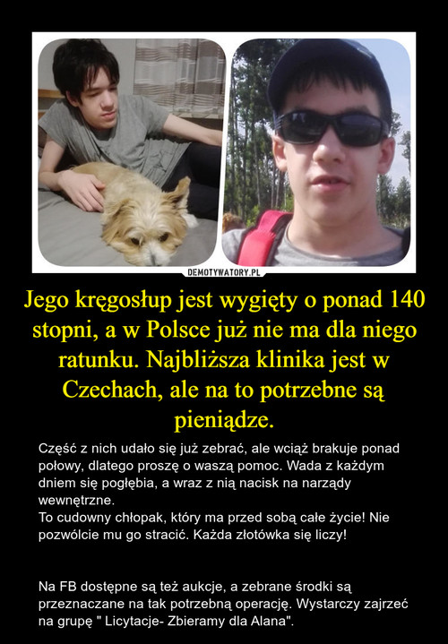 Jego kręgosłup jest wygięty o ponad 140 stopni, a w Polsce już nie ma dla niego ratunku. Najbliższa klinika jest w Czechach, ale na to potrzebne są pieniądze.