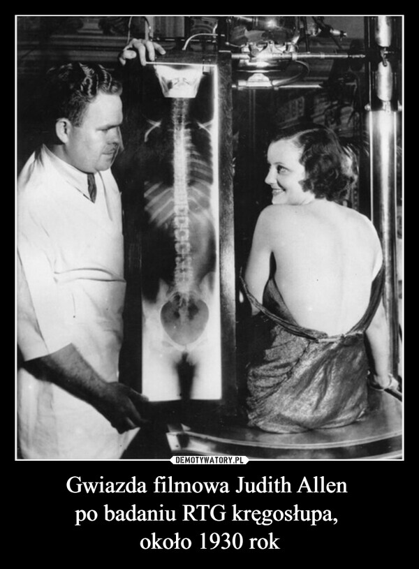 Gwiazda filmowa Judith Allen po badaniu RTG kręgosłupa, około 1930 rok –  